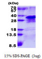 CHMP1A Protein