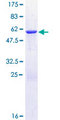 CHMP1B Protein - 12.5% SDS-PAGE of human CHMP1B stained with Coomassie Blue