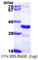 CHMP2B Protein