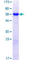 CHMP6 Protein - 12.5% SDS-PAGE of human CHMP6 stained with Coomassie Blue
