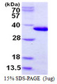 CHMP6 Protein