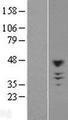 CHST10 Protein - Western validation with an anti-DDK antibody * L: Control HEK293 lysate R: Over-expression lysate