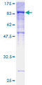 CILD9 / DNAI2 Protein - 12.5% SDS-PAGE of human DNAI2 stained with Coomassie Blue