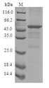 CISH / SOCS Protein - (Tris-Glycine gel) Discontinuous SDS-PAGE (reduced) with 5% enrichment gel and 15% separation gel.