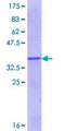 CLC Protein - 12.5% SDS-PAGE Stained with Coomassie Blue.