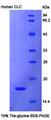 CLC Protein - Recombinant Charcot Leyden Crystal Protein By SDS-PAGE