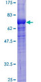 CLCN2 Protein - 12.5% SDS-PAGE of human CLCN2 stained with Coomassie Blue