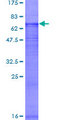 CLCNKB Protein - 12.5% SDS-PAGE of human CLCNKB stained with Coomassie Blue
