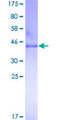 CLDN1 / Claudin 1 Protein - 12.5% SDS-PAGE of human CLDN1 stained with Coomassie Blue