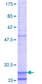 CLDN19 / Claudin 19 Protein - 12.5% SDS-PAGE Stained with Coomassie Blue.