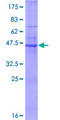 CLDN6 / Claudin 6 Protein - 12.5% SDS-PAGE of human CLDN6 stained with Coomassie Blue