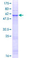 CLEC18C Protein - 12.5% SDS-PAGE of human MGC34761 stained with Coomassie Blue