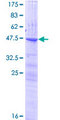 CLEC3A Protein - 12.5% SDS-PAGE of human CLEC3A stained with Coomassie Blue