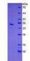 CLEC4C / CD303 / BDCA-2 Protein - Recombinant C-Type Lectin Domain Family 4, Member C By SDS-PAGE