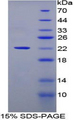 CLEC4M / L-SIGN / CD299 Protein - Recombinant C-Type Lectin Domain Family 4, Member M By SDS-PAGE