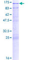 CLGN / Calmegin Protein - 12.5% SDS-PAGE of human CLGN stained with Coomassie Blue