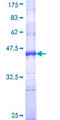 CLLP / CTNNAL1 Protein - 12.5% SDS-PAGE Stained with Coomassie Blue.
