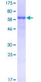 CLP1 Protein - 12.5% SDS-PAGE of human HEAB stained with Coomassie Blue