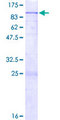 CLPB Protein - 12.5% SDS-PAGE of human CLPB stained with Coomassie Blue