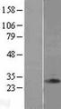 CLTB Protein - Western validation with an anti-DDK antibody * L: Control HEK293 lysate R: Over-expression lysate
