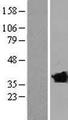 CLVS2 Protein - Western validation with an anti-DDK antibody * L: Control HEK293 lysate R: Over-expression lysate