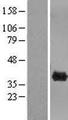 CLYBL Protein - Western validation with an anti-DDK antibody * L: Control HEK293 lysate R: Over-expression lysate
