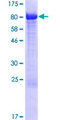 CMIP Protein - 12.5% SDS-PAGE of human CMIP stained with Coomassie Blue