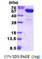 CNDP2 Protein