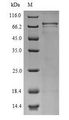 CNGA4 Protein - (Tris-Glycine gel) Discontinuous SDS-PAGE (reduced) with 5% enrichment gel and 15% separation gel.