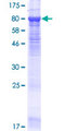CNGA4 Protein - 12.5% SDS-PAGE of human CNGA4 stained with Coomassie Blue