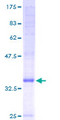CNIH4 / HSPC163 Protein - 12.5% SDS-PAGE of human HSPC163 stained with Coomassie Blue