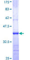 CNKSR1 Protein - 12.5% SDS-PAGE Stained with Coomassie Blue.