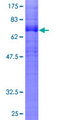 CNR1 / CB1 Protein - 12.5% SDS-PAGE of human CNR1 stained with Coomassie Blue