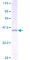 COA1 Protein - 12.5% SDS-PAGE of human FLJ10803 stained with Coomassie Blue