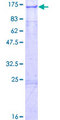 COG1 Protein - 12.5% SDS-PAGE of human COG1 stained with Coomassie Blue