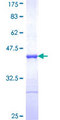 COG2 Protein - 12.5% SDS-PAGE Stained with Coomassie Blue.