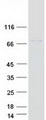 COG8 Protein - Purified recombinant protein COG8 was analyzed by SDS-PAGE gel and Coomassie Blue Staining