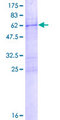 COL23A1 / Collagen XXIII Protein - 12.5% SDS-PAGE of human COL23A1 stained with Coomassie Blue