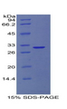 COL4A1 / Collagen IV Alpha1 Protein - Recombinant Collagen Type IV Alpha 1 By SDS-PAGE