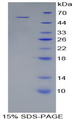 COL4A3 / Tumstatin Protein - Recombinant Collagen Type IV Alpha 3 By SDS-PAGE