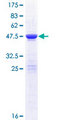 COMMD10 Protein - 12.5% SDS-PAGE of human COMMD10 stained with Coomassie Blue