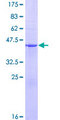 COMMD2 Protein - 12.5% SDS-PAGE of human COMMD2 stained with Coomassie Blue
