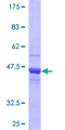 COMMD3 / BUP Protein - 12.5% SDS-PAGE of human COMMD3 stained with Coomassie Blue