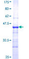 Complement C4b Protein - 12.5% SDS-PAGE Stained with Coomassie Blue.