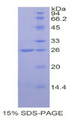 COMT Protein - Recombinant Catechol-O-Methyltransferase By SDS-PAGE