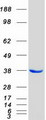 COPE Protein - Purified recombinant protein COPE was analyzed by SDS-PAGE gel and Coomassie Blue Staining