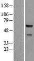 CORO2A Protein - Western validation with an anti-DDK antibody * L: Control HEK293 lysate R: Over-expression lysate