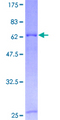 COX10 Protein - 12.5% SDS-PAGE of human COX10 stained with Coomassie Blue