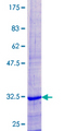COX8C Protein - 12.5% SDS-PAGE of human COX8C stained with Coomassie Blue