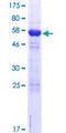 CPEB4 Protein - 12.5% SDS-PAGE of human CPEB4 stained with Coomassie Blue